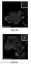 Fig. 07 - Plectin-1 binding antibodies and uses thereof
