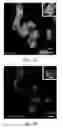 Fig. 09 - Plectin-1 binding antibodies and uses thereof