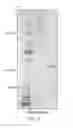 Fig. 06 - METHODS OF CONSTRUCTING IMMUNOGLOBULIN FUSION PROTEINS INHIBITING CATHEPSIN B AND COMPOSITIONS THEREOF