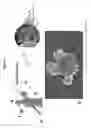 Fig. 03 - Devices, systems and methods for inhibiting invasion and metasases of cancer