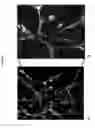 Fig. 09 - Devices, systems and methods for inhibiting invasion and metasases of cancer