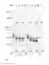 Fig. 06 - Beta-galactosidase enzymes