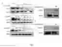 Fig. 04 - Read through of truncated proteins in premature termination codon diseases by suppressor tRNAs