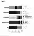 Fig. 02 - Method of detecting bacterial infection in a biological sample