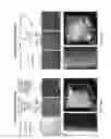 Fig. 07 - RNA fixation and detection in clarity-based hydrogel tissue