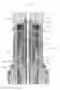 Fig. 03 - Tubing hanger alignment device