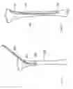 Fig. 09 - Flexible shaft for use as an internal splint for industrial application