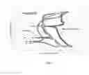 Fig. 08 - DIAGNOSTIC METHOD AND DEVICE FOR ASSESSING HUMAN JOINT FLUID REACTIVITY TO CoCrMo ALLOY