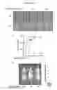 Fig. 07 - Method of treating cancer metastasis by CDK 4/6 inhibitors