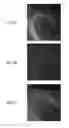 Fig. 07 - Super-resolution immunofluorescence with diffraction-limited preview