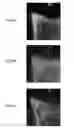 Fig. 08 - Super-resolution immunofluorescence with diffraction-limited preview