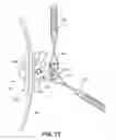 Fig. 48 - Spring assist cable clamp