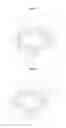 Fig. 04 - Lens moving apparatus