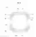 Fig. 05 - Lens moving apparatus
