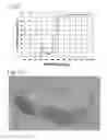 Fig. 04 - WEIGHT LOSS EYEGLASSES