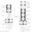 Fig. 01 - Image distortion transformation method and apparatus