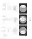 Fig. 06 - Image distortion transformation method and apparatus