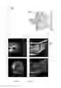 Fig. 06 - Determination and visualization of damage to an anatomical joint