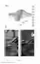 Fig. 07 - Determination and visualization of damage to an anatomical joint