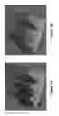 Fig. 12 - System and method for free-boundary surface extraction