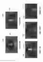 Fig. 14 - System and method for free-boundary surface extraction