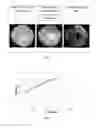 Fig. 08 - Panoramic visualization of coronary arterial tree