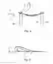 Fig. 05 - Plasma processing method