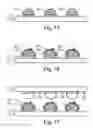 Fig. 06 - Package-on-package (PoP) structure including stud bulbs