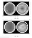 Fig. 19 - FORMULATIONS AND METHODS FOR ANTIFUNGAL ACTIVITY FROM PRUNUS MAACKII PERIDERM