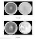 Fig. 20 - FORMULATIONS AND METHODS FOR ANTIFUNGAL ACTIVITY FROM PRUNUS MAACKII PERIDERM