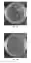 Fig. 26 - FORMULATIONS AND METHODS FOR ANTIFUNGAL ACTIVITY FROM PRUNUS MAACKII PERIDERM