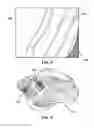 Fig. 06 - Wigs and Wig Elements and Related Methods