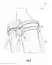 Fig. 05 - Dirt collector for a vacuum cleaner