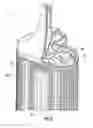Fig. 06 - Dirt collector for a vacuum cleaner