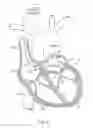 Fig. 08 - TISSUE VISUALIZATION AND MANIPULATION SYSTEM