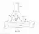 Fig. 10 - TISSUE VISUALIZATION AND MANIPULATION SYSTEM