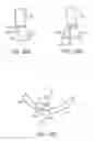 Fig. 34 - TISSUE VISUALIZATION AND MANIPULATION SYSTEM