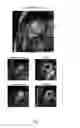 Fig. 02 - Left ventricle segmentation in contrast-enhanced cine MRI datasets