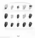Fig. 07 - Left ventricle segmentation in contrast-enhanced cine MRI datasets