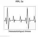 Fig. 03 - METHOD AND APPARATUS FOR PREDICTING POSTTRAUMATIC BEHAVIOR PROBLEM