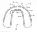 Fig. 01 - Systems and methods for integrating electronics into a mouth guard