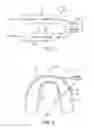 Fig. 04 - Systems and methods for integrating electronics into a mouth guard