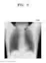 Fig. 09 - Medical imaging apparatus to automatically determine presence of an abnormality including a determination to transmit an assistance image and a classified abnormality stage