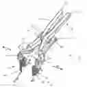 Fig. 01 - Method of using a surgical tissue retractor