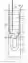 Fig. 01 - Tap-in bone anchor with expanding ring