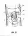 Fig. 18 - Apparatus for endoscopic procedures