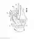 Fig. 49 - Apparatus for endoscopic procedures