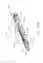 Fig. 63 - Surgical clip applier comprising adaptive control in response to a strain gauge circuit