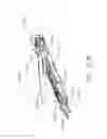 Fig. 63 - Clip applier comprising a movable clip magazine