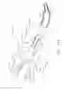 Fig. 91 - Clip applier comprising a movable clip magazine